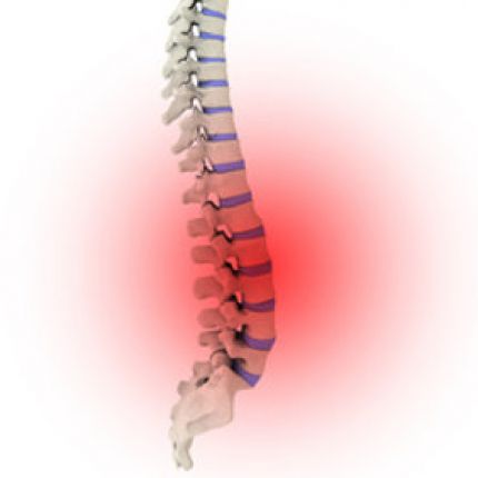 Chronische Rückenbeschwerden