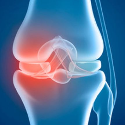 Knieprobleme